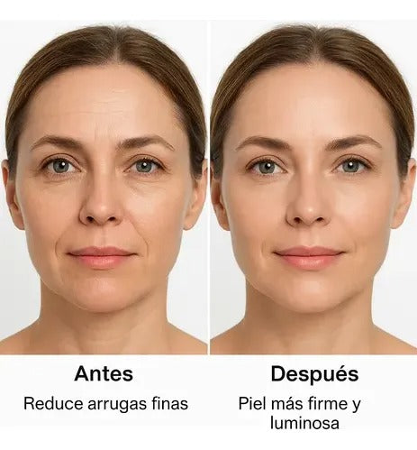 Kit Tratamiento Anti-Edad Sin Cirugía | Frente, Ojos y Mejillas